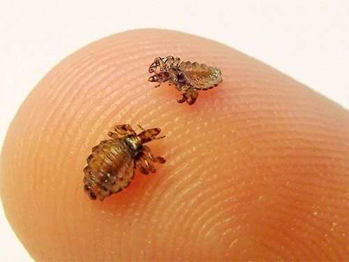 Écraser les poux dans un rêve peut être un signe favorable