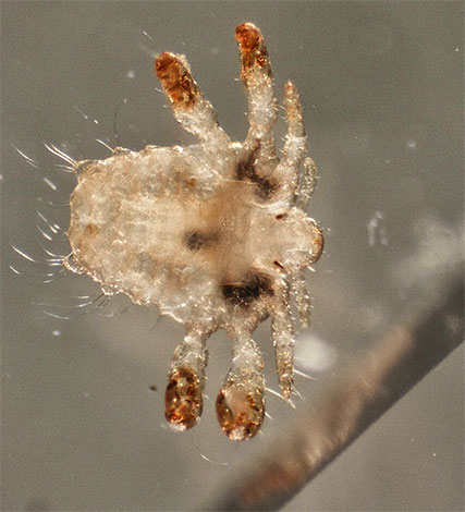 Certains livres de rêve prédisent une amélioration du bien-être si un pou du pubis apparaît dans un rêve