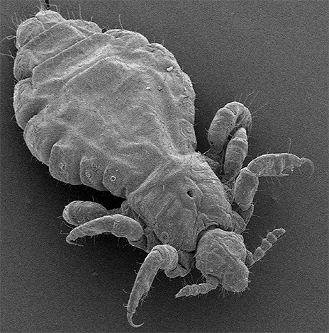 Les poux de lin sous le microscope