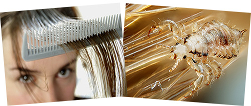 Essayons de comprendre comment interpréter les rêves avec des poux sur les cheveux