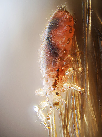 L'idée d'un citadin moderne à propos des poux diffère généralement considérablement de l'attitude des résidents ruraux vis-à-vis de ces parasites d'autrefois.