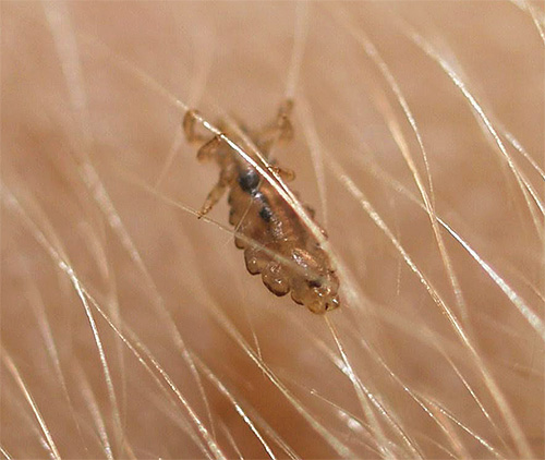 La photo montre que le pou se confond presque en couleur avec les cheveux