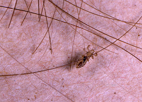 Le pou s'accroche fermement aux cheveux avec ses pattes