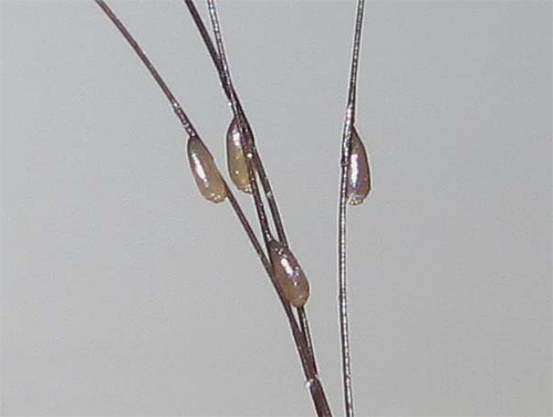 Quelques lentes dans les cheveux