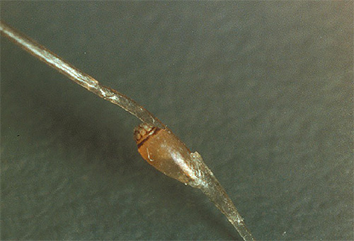 Lentes de pou du pubis sur les cheveux