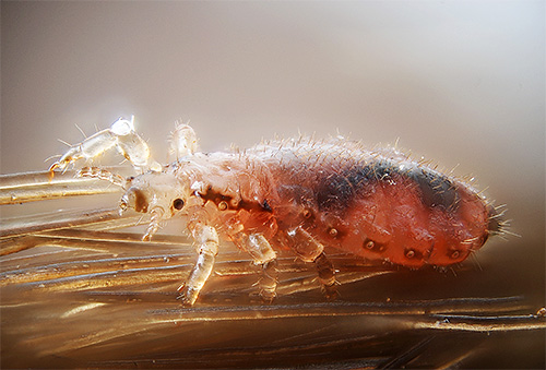 poux sur les cheveux