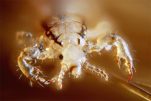 Sur la photo - gros plan sur les poux de tête
