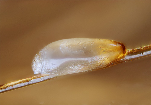 Lentes sur les cheveux