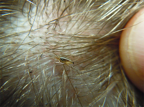 Pou de tête parmi les cheveux d'un enfant