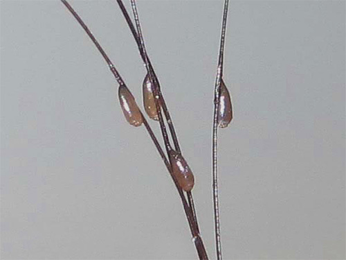 Les lentes attachées aux cheveux ne sont que des œufs de poux