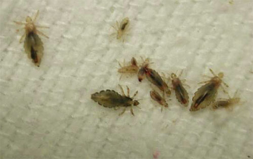 Voyons comment se débarrasser correctement des poux et des lentes, ainsi que quels médicaments et méthodes de lutte contre les parasites dans les cheveux sont les plus efficaces.