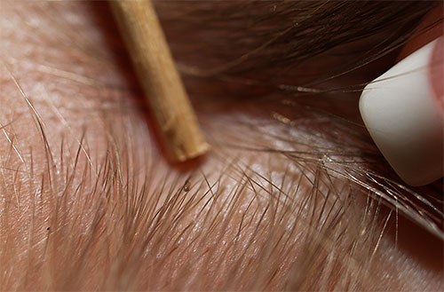 Les lentes sont de très petite taille, donc même le peignage avec des peignes spéciaux devra être fait plusieurs fois.