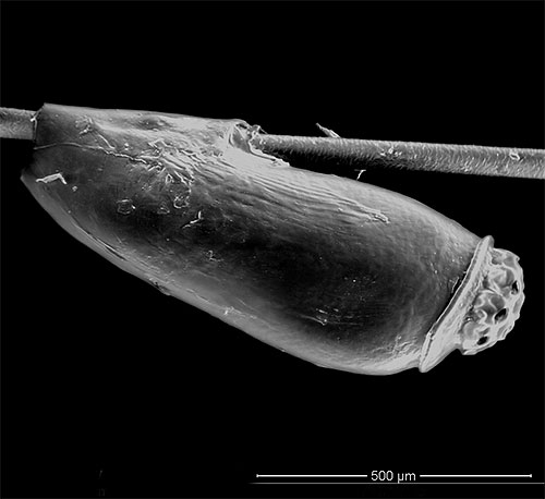 Le pou femelle attache très fermement la lente aux cheveux avec un secret collant spécial.