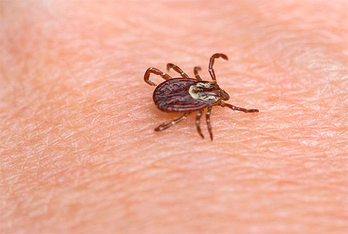 Tique sur la peau humaine : on voit bien que cet insecte a 8 pattes