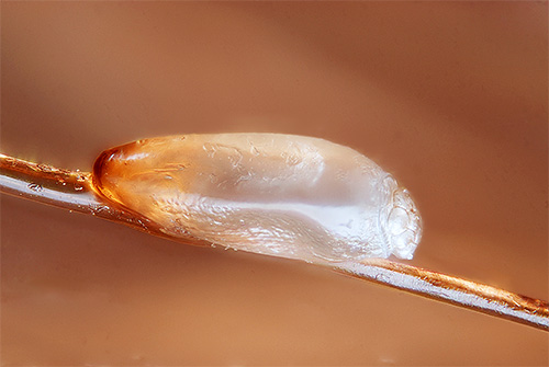 Les lentes sont les plus difficiles à retirer de la tête, car elles sont très fermement attachées aux cheveux avec un secret collant.