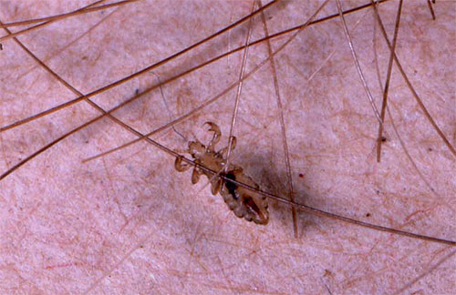 Le pou de tête s'accrochait aux cheveux avec ses pattes