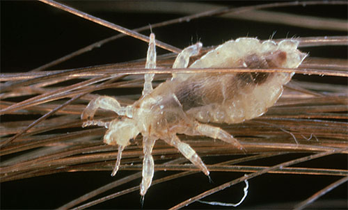 Le pou de tête est capable de s'agripper très fermement aux poils grâce à la structure spécifique des pattes.