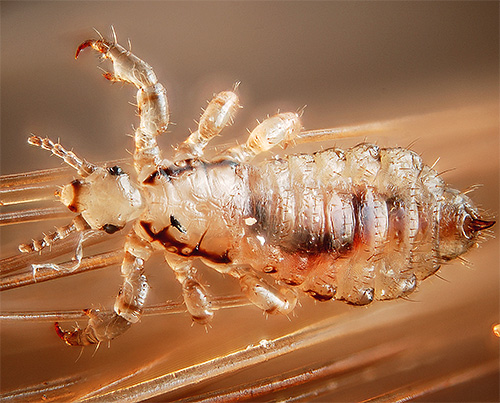 Avis d'expert: il est peu probable qu'il soit possible d'éliminer complètement les poux avec du savon au goudron seul.