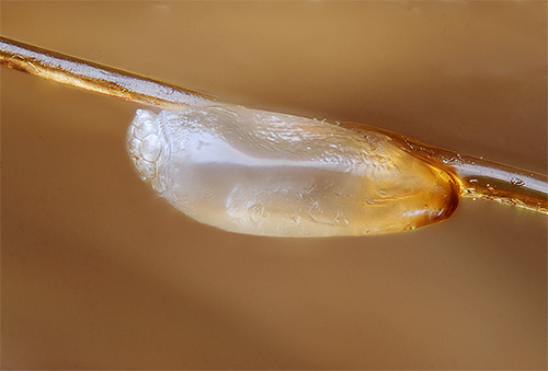 S'il n'a pas été possible de se débarrasser des lentes la première fois, le traitement doit être répété après un certain temps