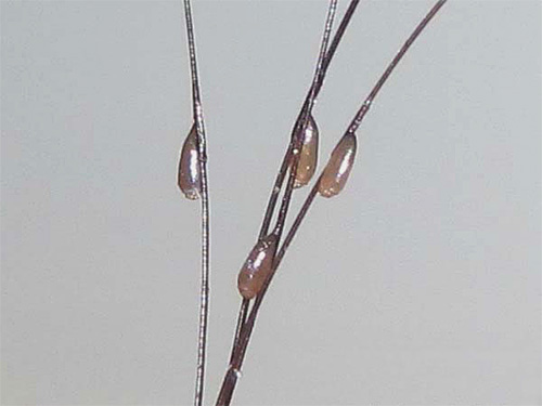 Malheureusement, même les insecticides modernes n'aident pas toujours à se débarrasser des lentes.