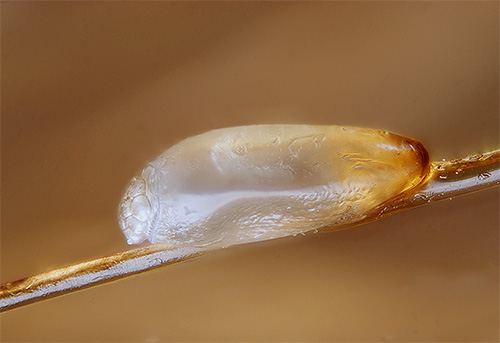 Mais les composants de Paranit n'ont pratiquement aucun effet sur les lentes