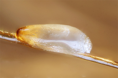 Les lentes trouvées sur les cheveux indiquent clairement la présence de poux