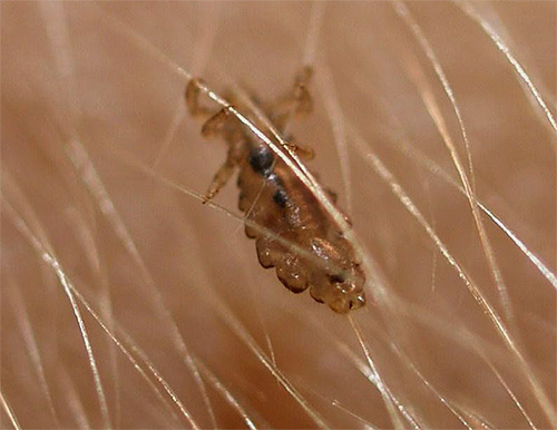 Les poux avec un petit nombre d'entre eux ne sont pas si faciles à détecter, car ils sont petits et se cachent à la racine des cheveux.