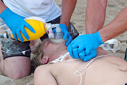 Chez les personnes sensibles aux venins d'insectes, un essoufflement et un choc anaphylactique peuvent survenir après une morsure de frelon.