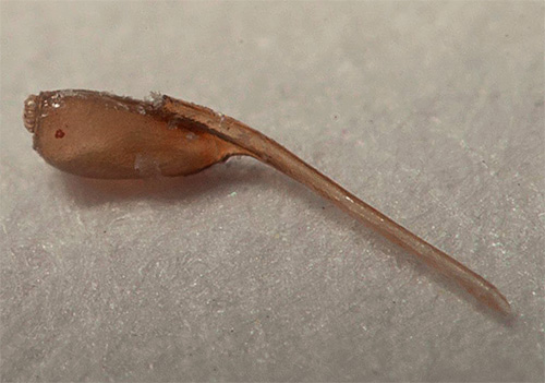 La psychanalyse considère les poux et les lentes dans un rêve comme une image déformée des problèmes.