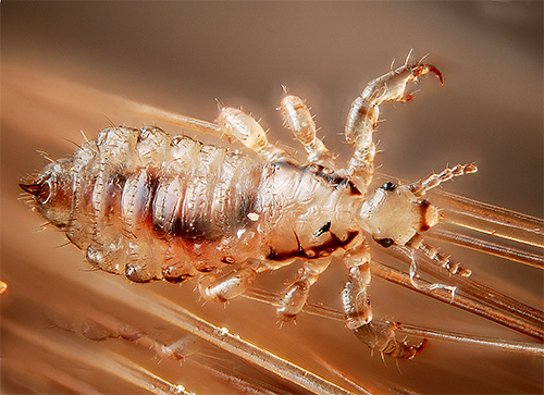 L'interprétation des rêves avec des poux et des lentes pour différentes personnes peut varier considérablement