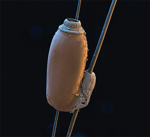 Lentes sur les cheveux