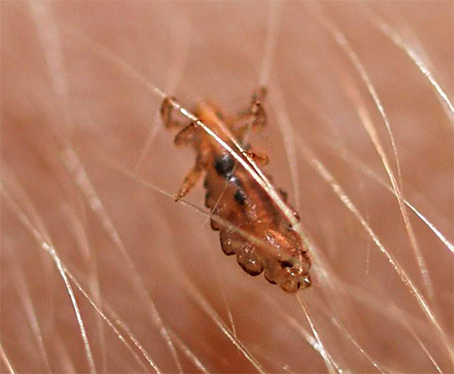 Il est peu probable qu'il soit possible de détruire les poux à l'aide d'huile d'anis seule.