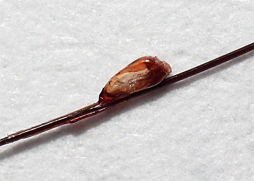 Dans la lutte contre les lentes, l'huile d'anis est inefficace