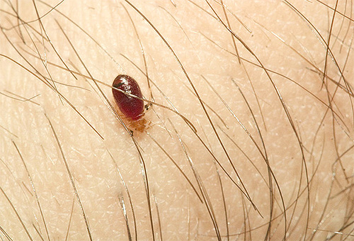 Malgré les craintes de beaucoup que les punaises de lit puissent être porteuses du VIH, il n'y a aucune preuve de cela.