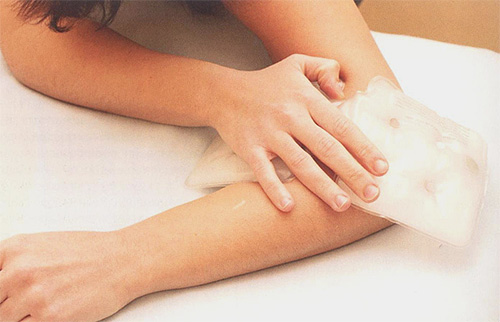 Comme premiers soins pour les piqûres d'insectes, presque toutes les compresses froides feront l'affaire.