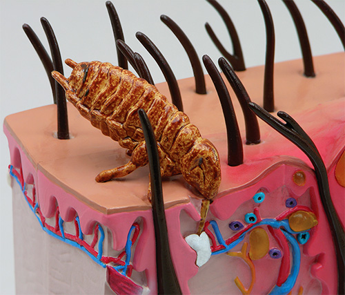 L'insecte perce la peau avec des poils spéciaux pour atteindre le vaisseau sanguin.