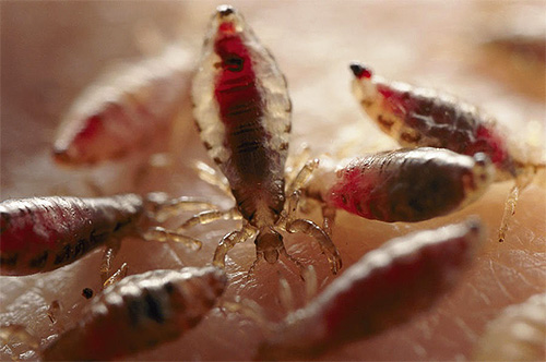 Sur la photo, il y a beaucoup de poux qui ont bu du sang