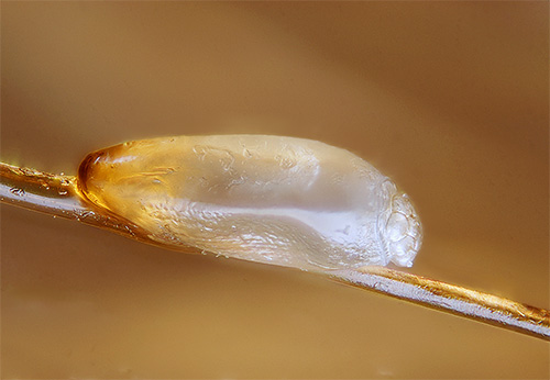 Et voici à quoi ressemble une lente sur un cheveu à fort grossissement sous un microscope