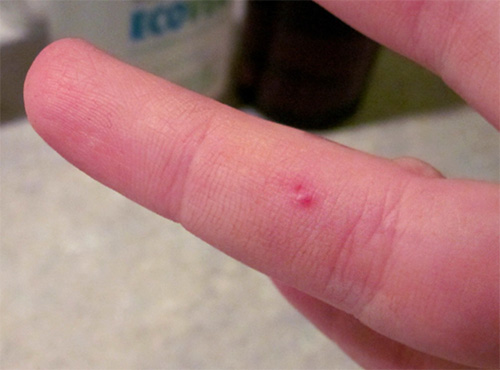 Contrairement aux abeilles, les guêpes ne laissent pas leur dard là où elles piquent.