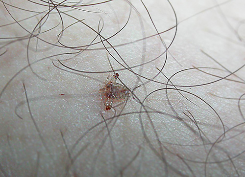 Et ça ressemble à un pou du pubis, Pthirus pubis