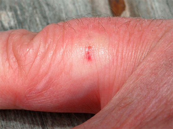 Immédiatement après la morsure, vous pouvez essayer d'aspirer le poison de la plaie, l'essentiel est de ne pas en faire trop pour ne pas perdre un temps précieux.