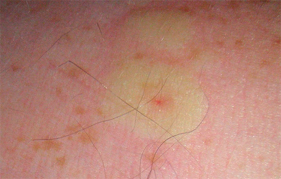 Le frelon, contrairement à l'abeille, ne laisse pas son dard dans la plaie.