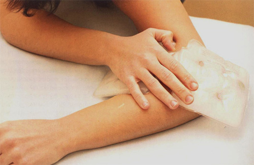 Pour réduire l'enflure et les démangeaisons, il est utile d'appliquer une compresse froide sur le site d'une piqûre d'insecte.