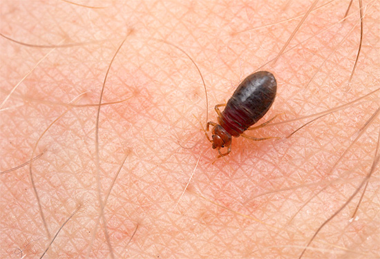 La photo montre une punaise de lit en train de sucer du sang