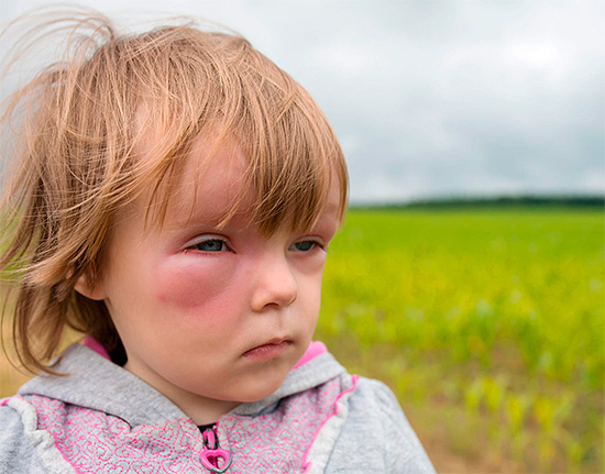 Lorsque vous prodiguez les premiers soins à un enfant, il ne faut pas oublier que de nombreux médicaments contre les allergies ne sont pas destinés à être utilisés pendant l'enfance.