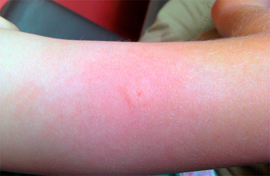 Lors de la fourniture des premiers soins à une personne après une piqûre de guêpe, il convient de rappeler que certaines actions incorrectes peuvent nuire à la santé de la victime.