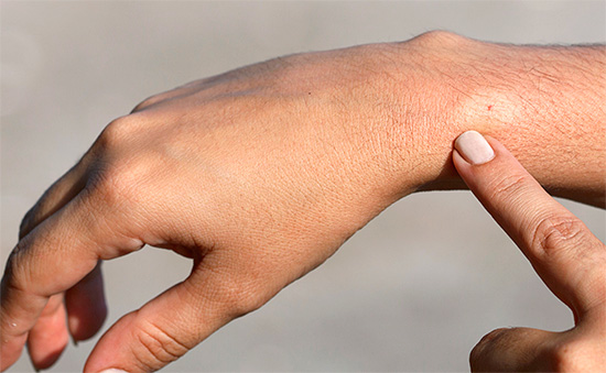 Les premiers secours en cas de piqûre de guêpe doivent être donnés immédiatement, sans perdre de précieuses minutes en émotions.