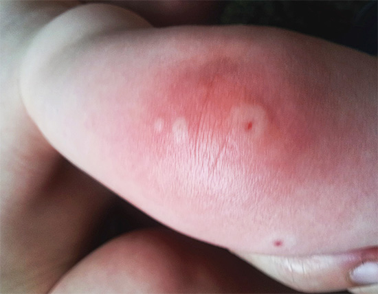 Dans la plupart des cas, les guêpes n'utilisent leur dard que pour se défendre.