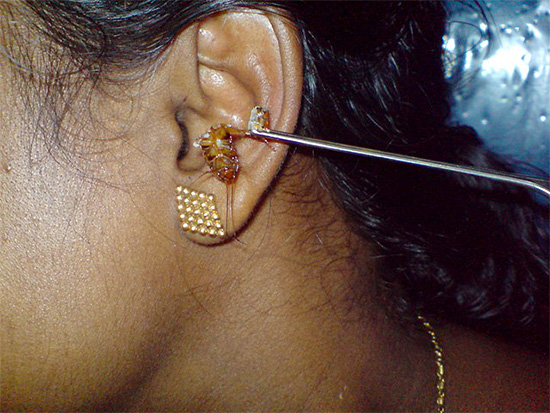 Souvent, les cafards rampent dans les oreilles des gens, et il peut parfois être très problématique d'en extraire un insecte.