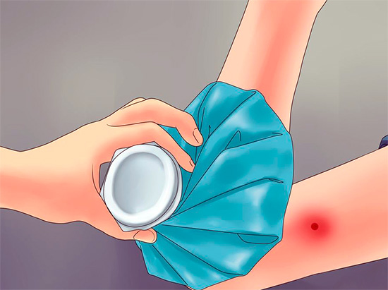 Une compresse froide resserre les vaisseaux sanguins et ralentit le flux de poison dans la circulation sanguine.